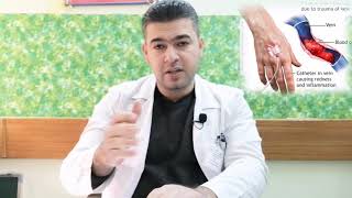 Thrombophlebitis التهاب الوريد الخثري