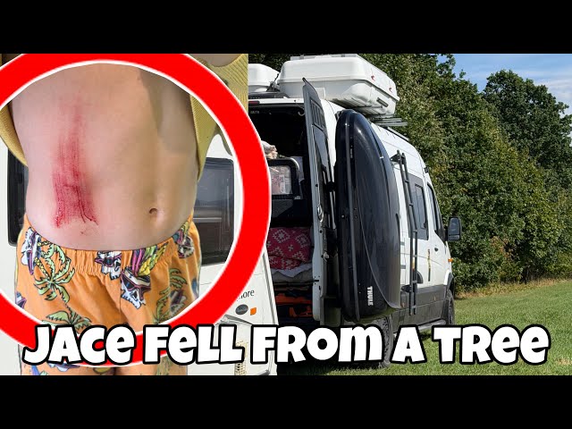 Jace Had a Nasty Accident Falling from a TREE!