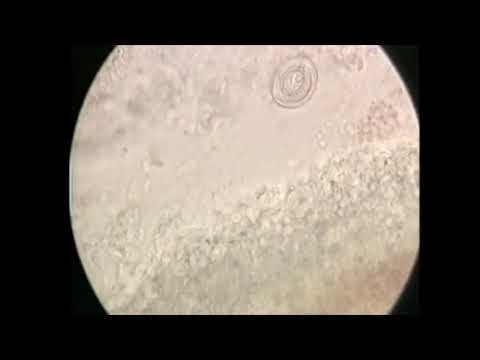 Trichodina - parasite diseases in trout - signs, identification, treatment