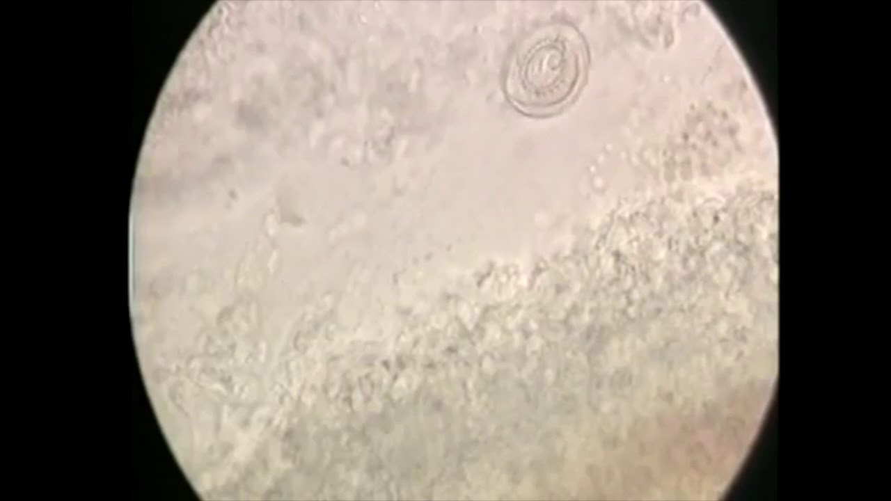 Trichodina - parasite diseases in trout - signs, identification, treatment