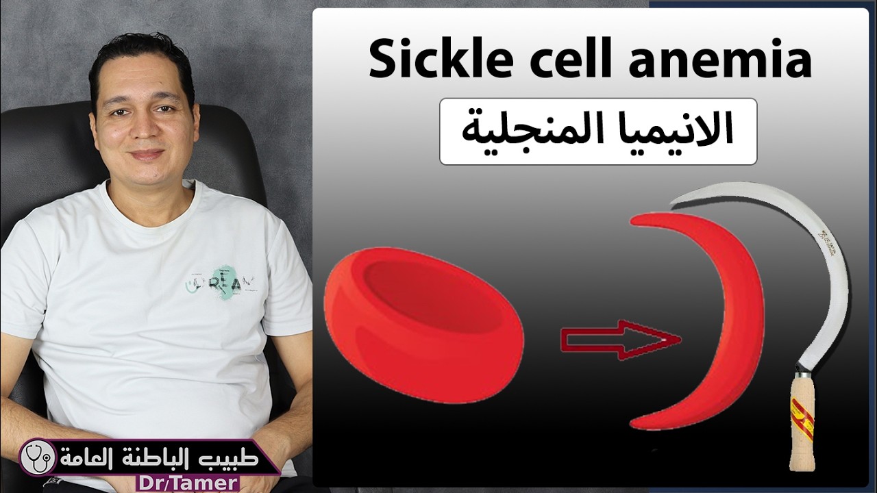 الانيميا المنجلية / Sickle cell anemia