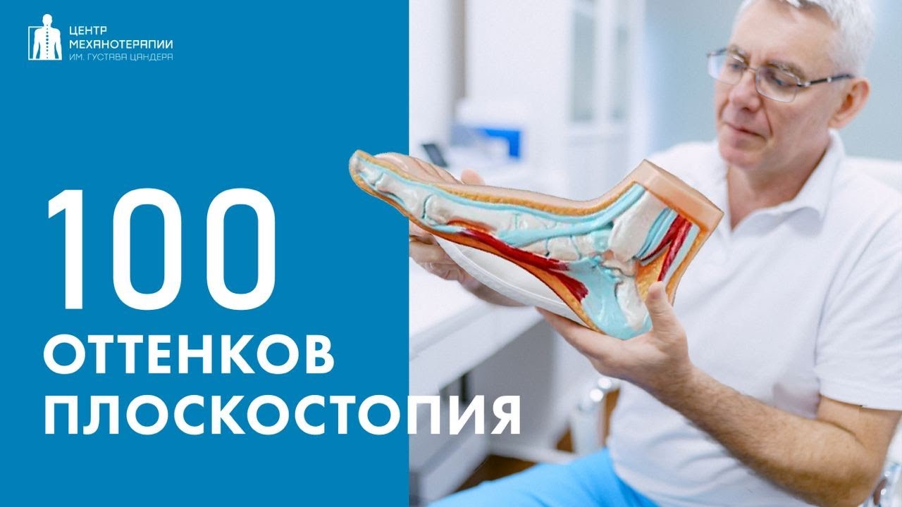 100 Оттенков плоскостопия - YouTube