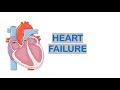 Heart Failure: Pathophysiology | Clinical features | Diagnosis | Management