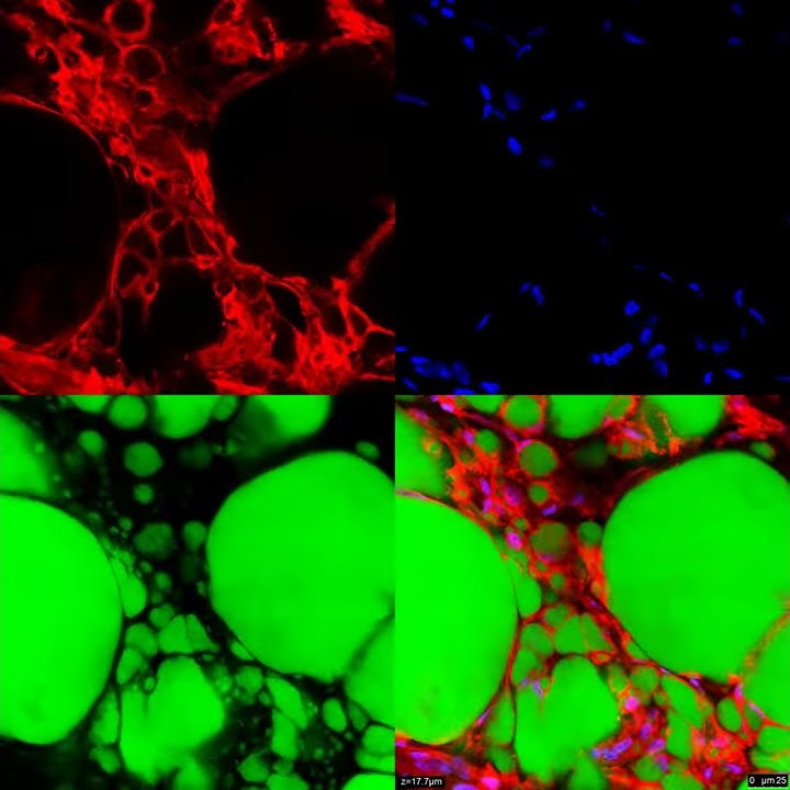 Innovative Technique Converts White Fat to Brown Fat