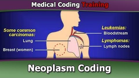 ICD 9 Coding Tutorial — Neoplasm Coding