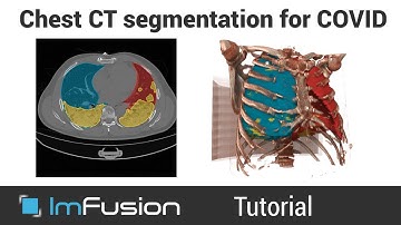 ImFusion Labels - How to segment 3D Chest CT for COVID