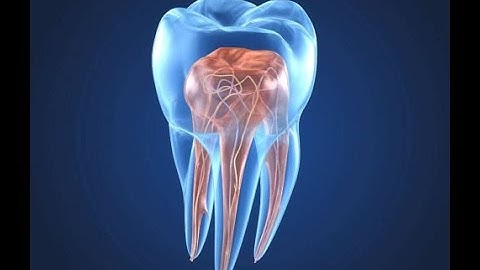 Endodontics II lecture 6. (Procedural Errors During Cleaning and Shaping)