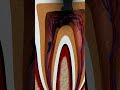 What is Root Canal Treatment? 🦷👀