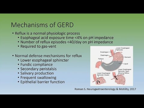 Gastroesophageal Reflux Disease for Individuals with Developmental Disabilities