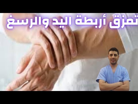 إصابة اليد والمعصم كيفية علاج تمزق أربطة الرسغ واليد التواء مفصل اليد دكتور احمد حسن جمعه