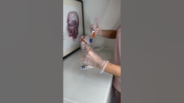 PRP with Exosomes #clinicbe #aesthetics #exosomes #prp #prf