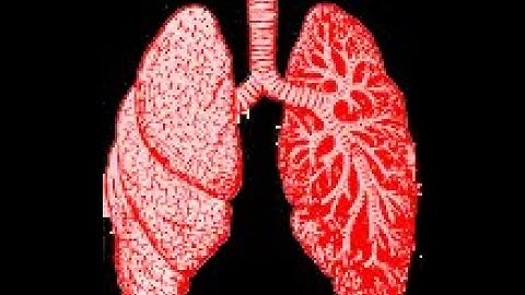 Spontaneous breathing in ARDS_Pro-debate_Dr Pradeep Rangappa