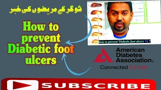 How to prevent Diabetic foot ulcers 👣 | Diabetic foot ulcers 👣 #diabetes #diabeticfoot