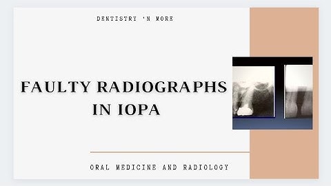 FAULTY RADIOGRAPHS IN RADIOGRAPHY