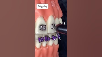Mô phỏng gắn mắc cài khi niềng răng 🫶🏻 #video #shortsvideo #shortsviral #dentist