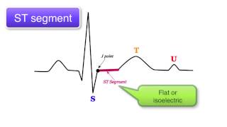 ECG Basics 9/10 - ST interval, T wave and U wave