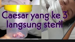 3RD C-SECTION DELIVERY AND STERILIZATION