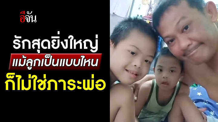 รักสุดยิ่งใหญ่ แม้ลูกเป็นแบบไหน ก็ไม่ใช่ภาระพ่อ | อีจัน EJAN