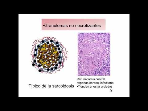 7     A Pat  Inflamación granulomatosa  Virus mp4