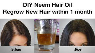 Regrow Your Hair With My DIY Neem Hair Oil