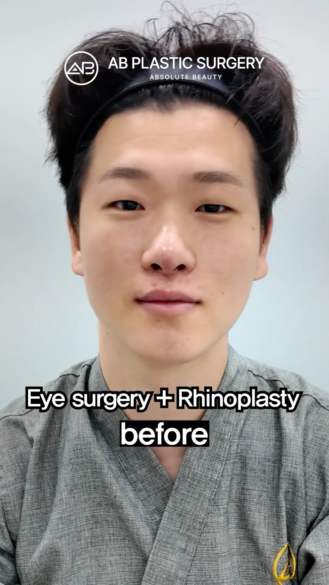 His Eye & Nose Surgery Sharpened His Look #shorts