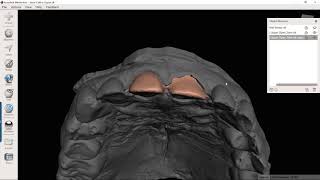 Creating a prepped tooth model in Meshmixer