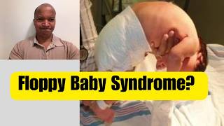 Floppy Baby Syndrome | Low Muscle tone (Hypotonia) Explained