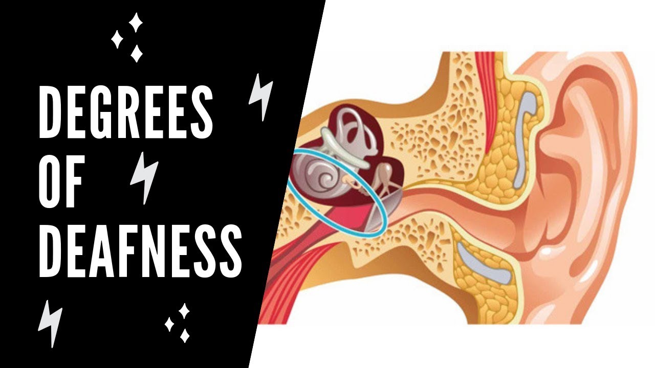 Degrees of Deafness YouTube