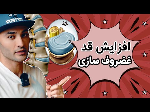 چطور با غضروف سازی افزایش قد داشته باشیم ۳۹۰