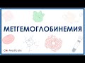 Метгемоглобинемия: что такое, причины развития, виды, симптомы, принцип лечения