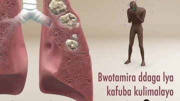 Treatment of Tuberculosis - Lugandan