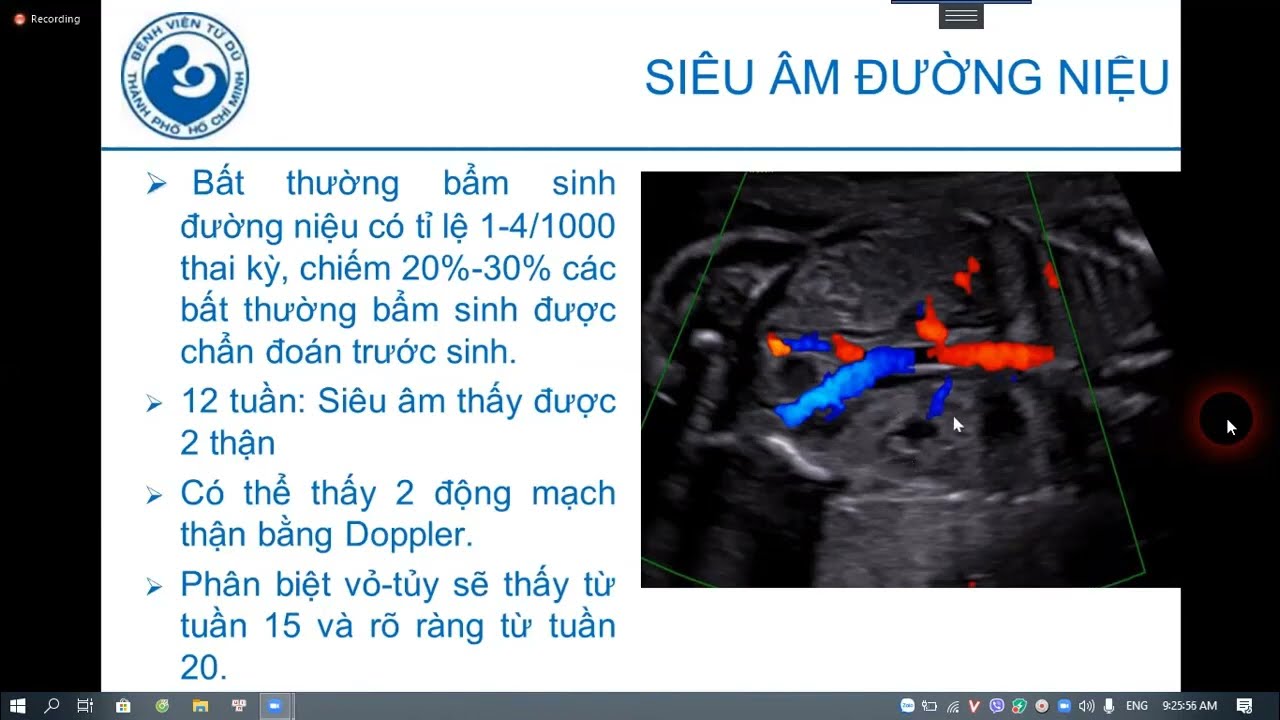 26 Siêu âm hệ tiết niệu thai - BS.CK1. Lê Thị Thanh Tú
