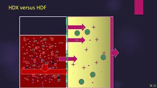 Prof. Hesham Elsayed : HDX versus HDF part 1 screenshot 1