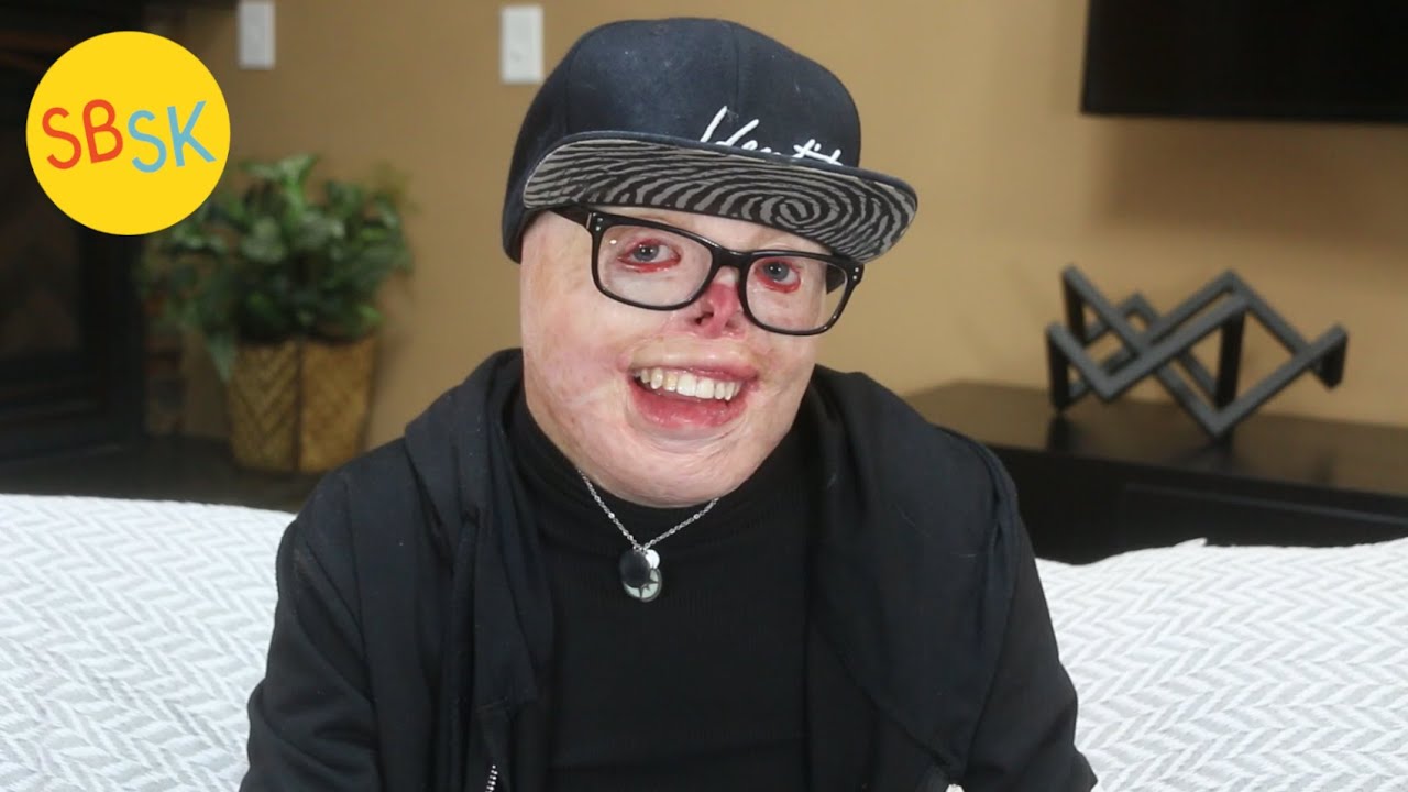 Jadiant's Survival Story (Learning to Love Himself After a Tragedy ...