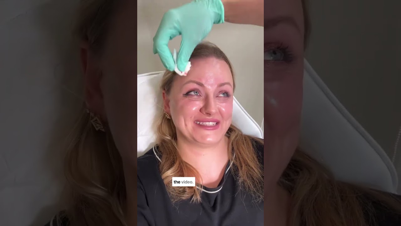 Wrinkle Treatment Windsor – Anti-Wrinkle Injections at Bare Brilliance