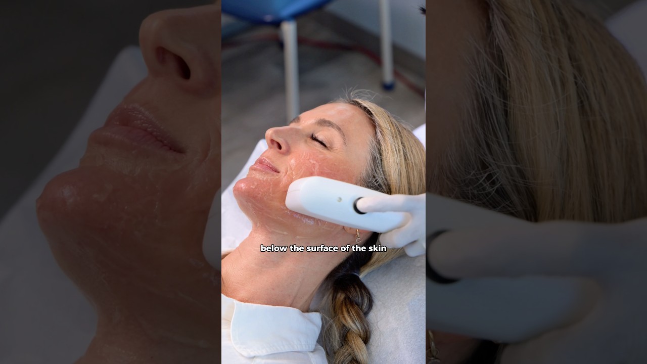 Banner for What Are the Best Non Surgical Skin Tightening Options?  #nonsurgicalaesthetics #sofwave #ultherapy