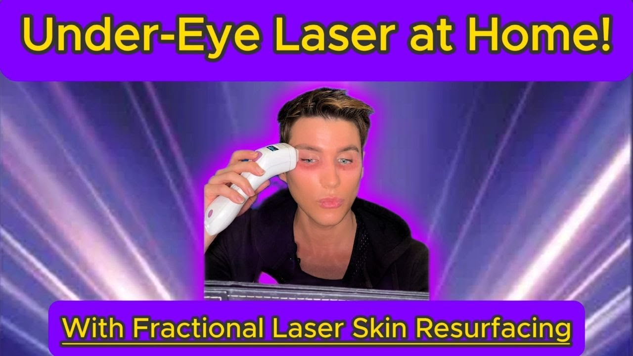 I Used a Laser Under My Eyes at Home—Here’s What Happened 