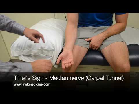 Tinel's Sign - Median nerve (Carpal Tunnel)