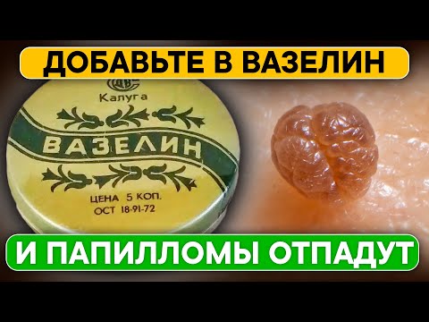 Смесь возрождения! Папилломы, бородавки и другие образования на коже высохнут и отпадут!