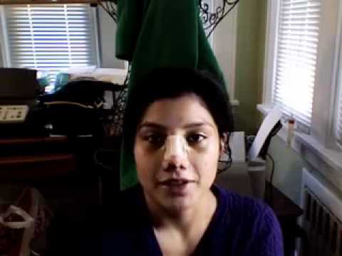 Video thumbnail: Part 6 Female Hispanic Rhinoplasty Diary (Day 5) · Dr. Sam Rizk