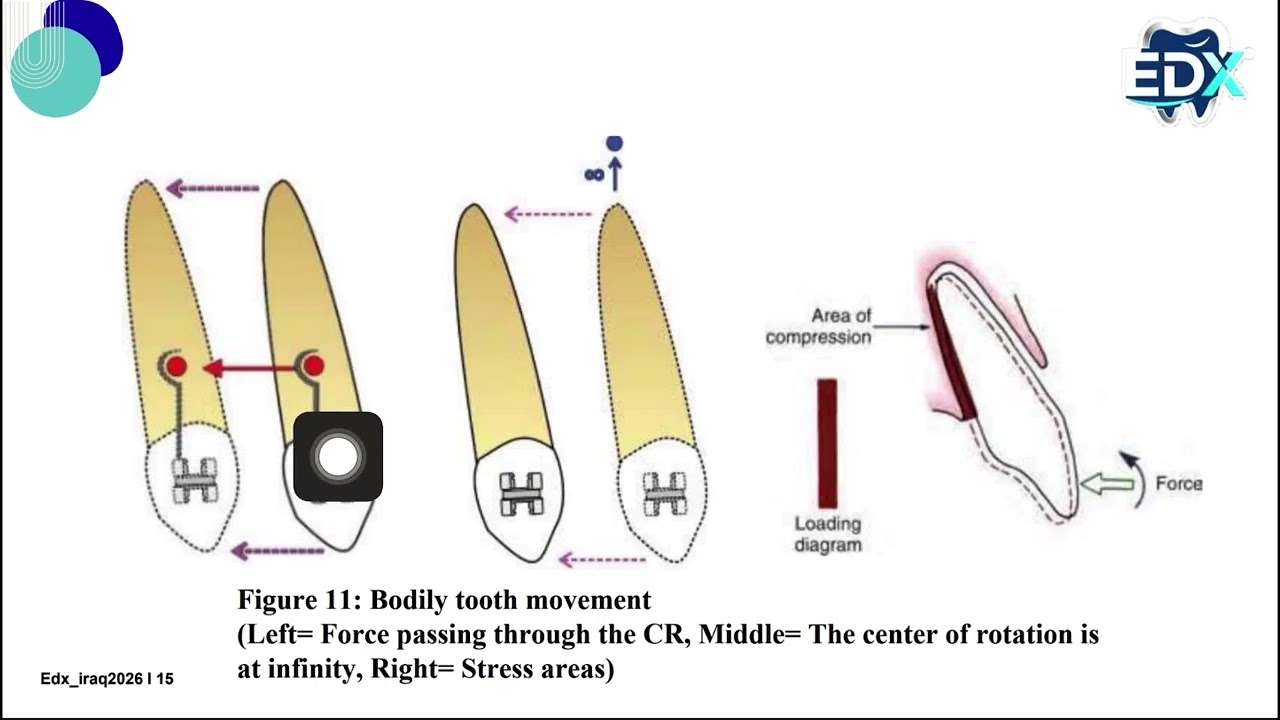 Biomechanical Concepts of Tooth Movementsشرح محاضره الاورثو بعنوان 