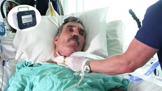 Mechanical Insufflation-Exsufflation With A Tracheostomy