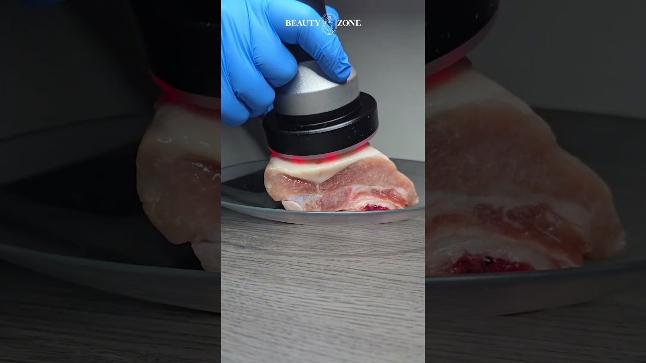 ¿cómo funciona la cavitación?