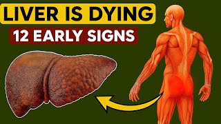 12 Strange Signs Your Liver Is Dying – Don’t Ignore These Warnings!