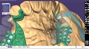 INSIGHTS 2018  PartialCAD Case Demonstration   Bridge with attachments and partial Part II