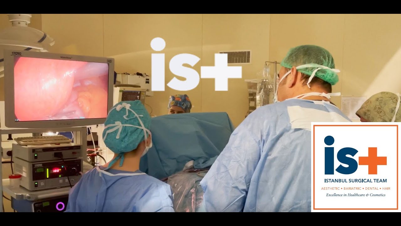 Gastric Sleeve Surgery YouTube