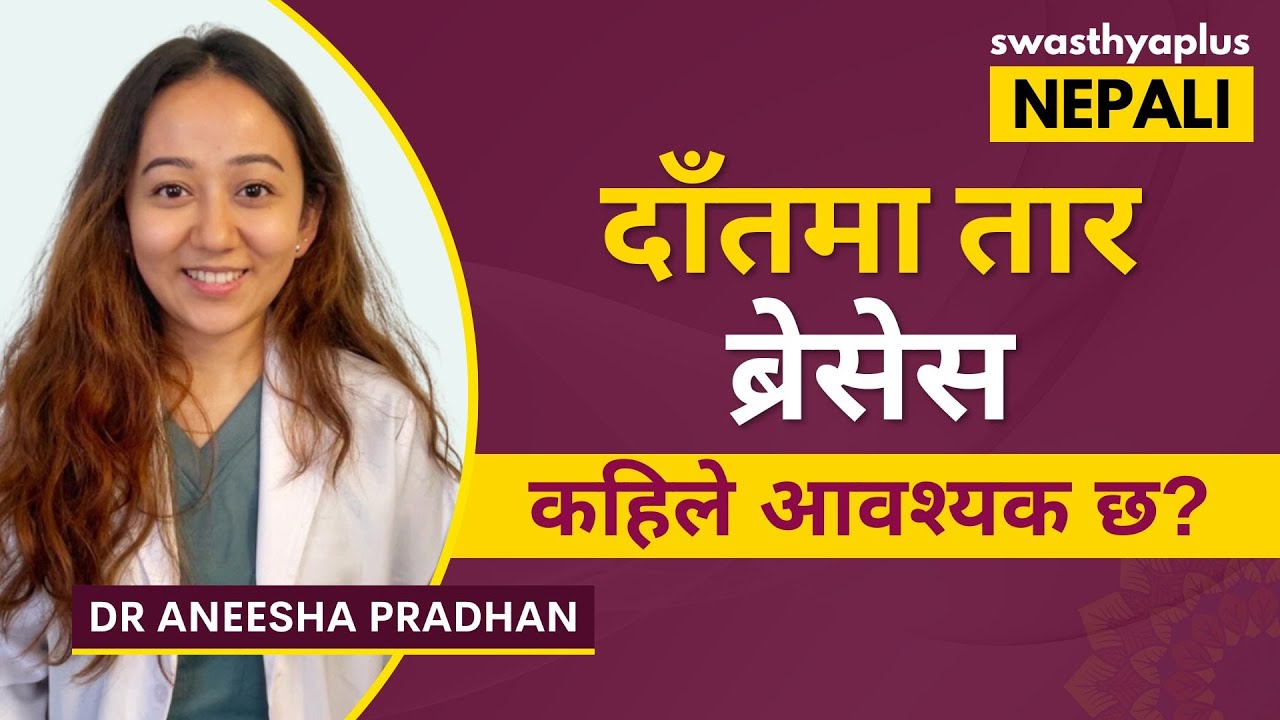 ब्रेसेस लगाउ किन आवश्यक छ? Dental Braces in Nepali Types & Uses