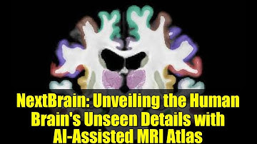 NextBrain: Unveiling the Human Brain