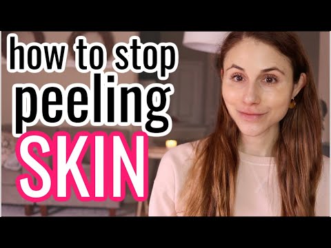 How to STOP PEELING SKIN| Dr Dray