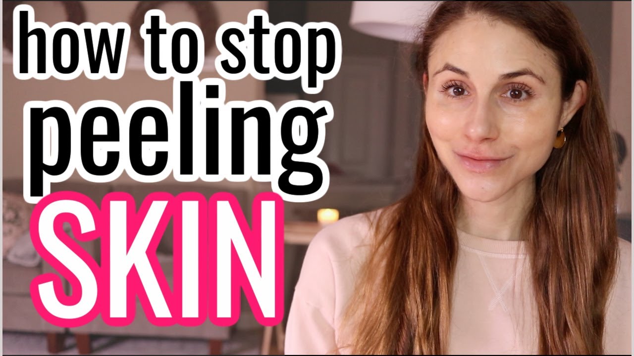 Meaning of Peeling in LoL and Guide on How to Peel